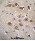 RAB40AL Antibody (N-term)